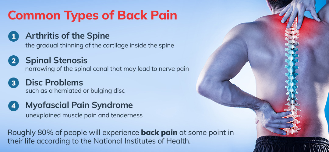 Understanding Back Pain