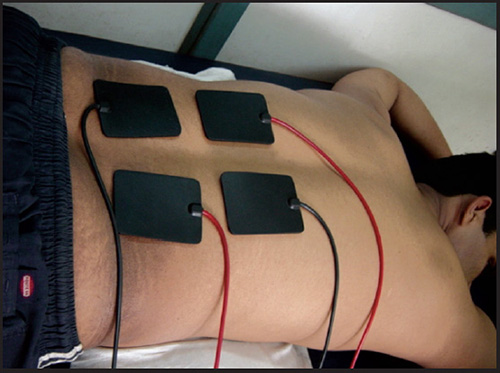Interferential Therapy (IFT)